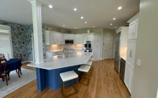 After_NHance_Refacing