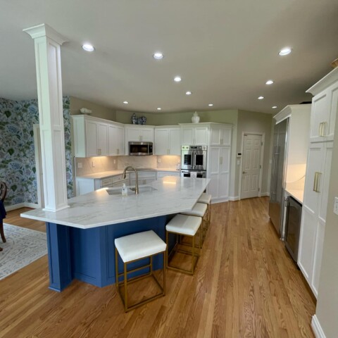 After_NHance_Refacing