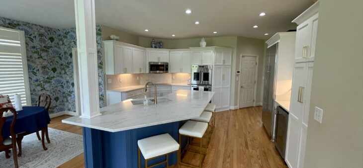 After_NHance_Refacing
