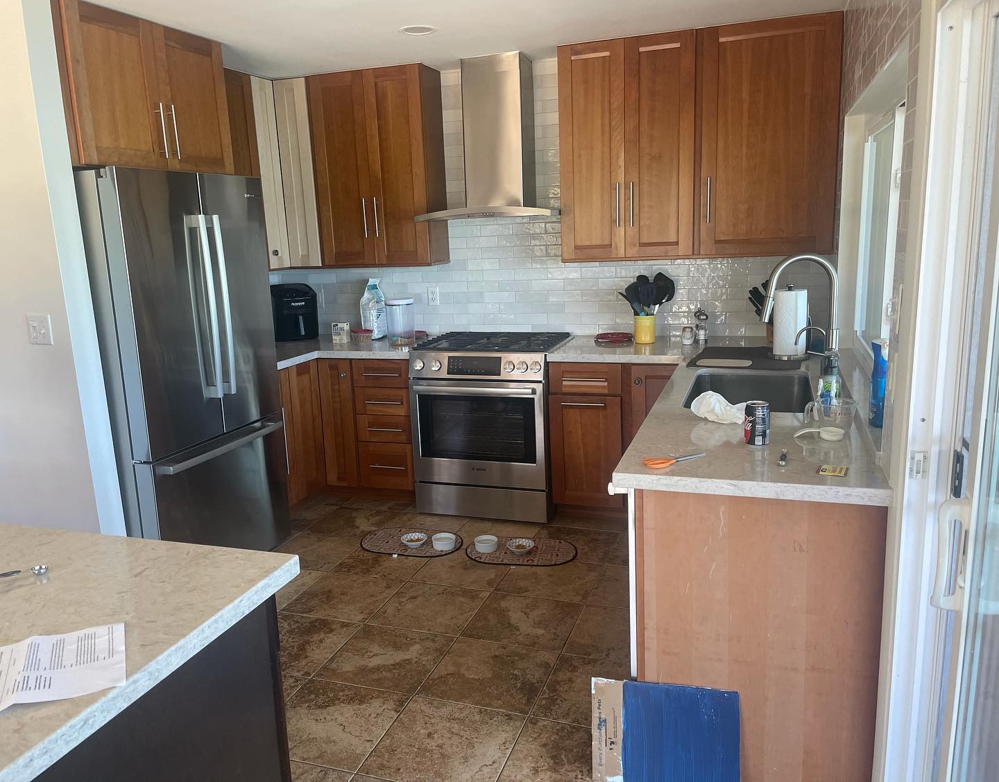 before refacing
